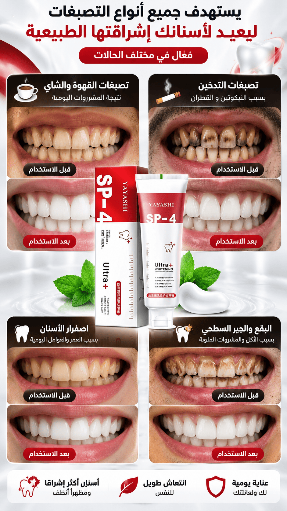 معجون تبييض الأسنان — 2